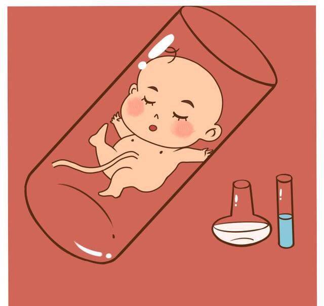 第二代试管婴儿