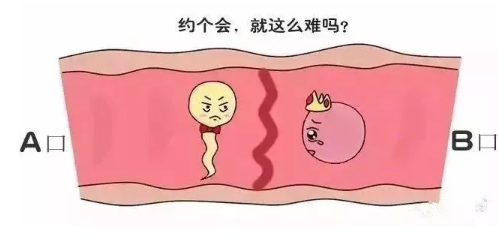第三代试管婴儿