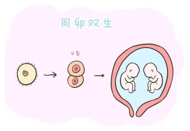 第二代试管婴儿