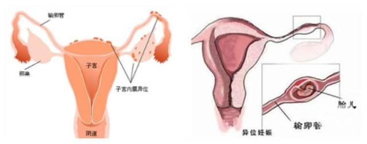 儋州助孕呕.309584上词扣