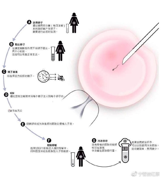 免疫性不孕